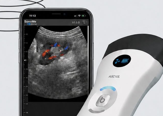 Đầu dò SonoMe AGC10L và màn hình ứng dụng SonoMe Pro