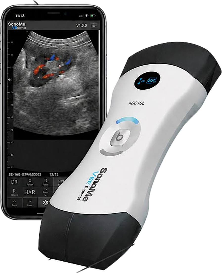 SonoMe – máy siêu âm cầm tay không dây bionet AGC10L cùng ứng dụng trên điện thoại